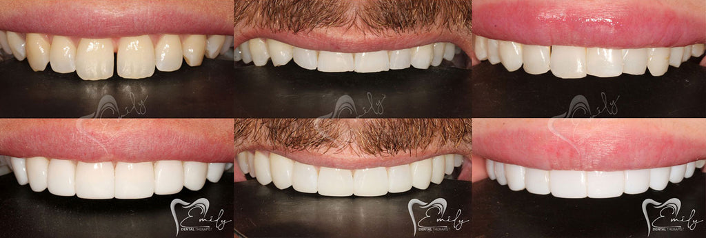 Mini Smile Makeovers