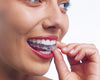 Invisalign clear braces